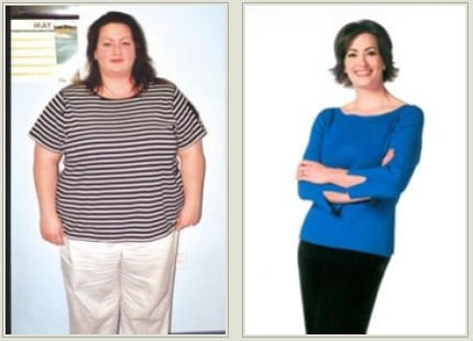 Gastric Bypass Patient