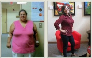 Post-Bariatric Surgery Patient